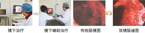肛乳头肥大是怎么回事
